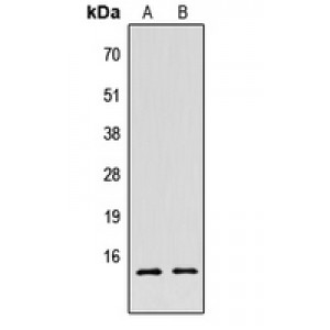 LifeSab™ Histone H2B (AcK5) Rabbit pAb (50 µl)