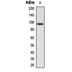 LifeSab™ IGF1 Receptor (pY1161) Rabbit pAb (50 µl)