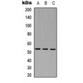 LifeSab™ TPL2 Rabbit pAb (50 µl)