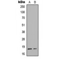 LifeSab™ Alpha-synuclein Rabbit pAb (50 µl)