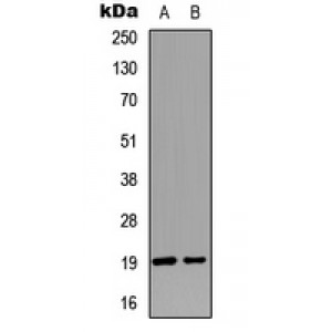 LifeSab™ STMN1 (pS25) Rabbit pAb (50 µl)