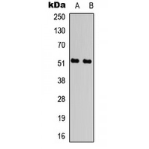 LifeSab™ ATF2 (pT71) Rabbit pAb (50 µl)