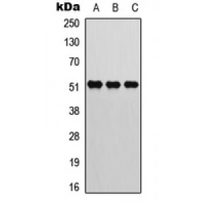 LifeSab™ ATF2 (pT73) Rabbit pAb (50 µl)