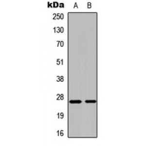 LifeSab™ CMPK1 Rabbit pAb (50 µl)