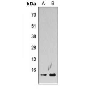 LifeSab™ Histone H2A.Z (AcK5) Rabbit pAb (50 µl)