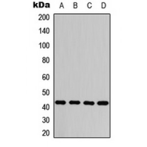 LifeSab™ PKA C alpha/beta/gamma (pT198) Rabbit pAb (50 µl)