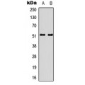 LifeSab™ SMAD3 (pS213) Rabbit pAb (50 µl)