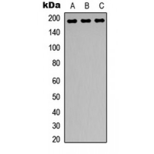 LifeSab™ HER2 (pY1248) Rabbit pAb (50 µl)