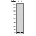 LifeSab™ CBP20 Rabbit pAb (50 µl)