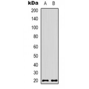 LifeSab™ CBP20 Rabbit pAb (50 µl)