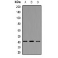 LifeSab™ AT1 Rabbit pAb (50 µl)