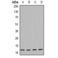 LifeSab™ HSP20 (pS16) Rabbit pAb (50 µl)