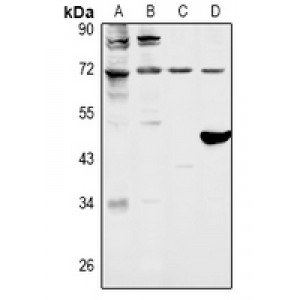 LifeSab™ FOXO1 Rabbit pAb (50 µl)