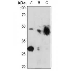 LifeSab™ Kir6.2 (pT224) Rabbit pAb (50 µl)