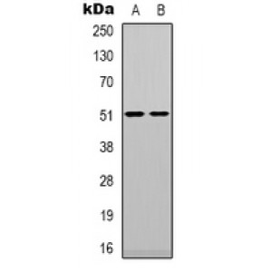 LifeSab™ TPH1 Rabbit pAb (50 µl)