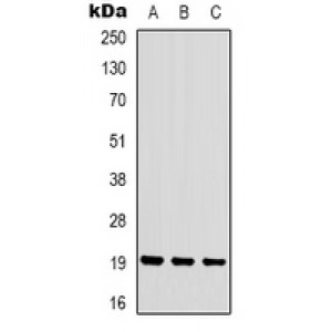 LifeSab™ STMN1 (pS16) Rabbit pAb (50 µl)