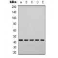 LifeSab™ p38 (pY182) Rabbit pAb (50 µl)