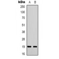 LifeSab™ STMN1 (pS38) Rabbit pAb (50 µl)