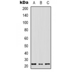 LifeSab™ RPS20 Rabbit pAb (50 µl)