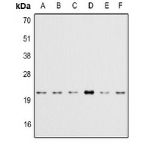 LifeSab™ FLAG-tag Rabbit pAb (50 µl)