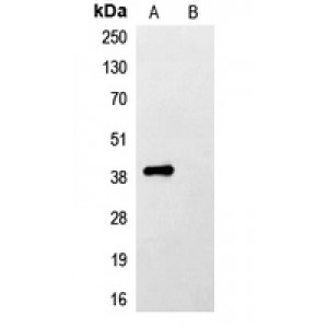 LifeSab™ His-tag Rabbit pAb (50 µl)