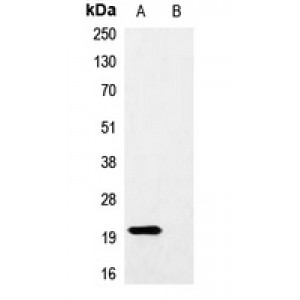 LifeSab™ HA-tag Mouse mAb (50 µl)