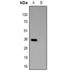 LifeSab™ HSV-tag Rabbit pAb (50 µl)