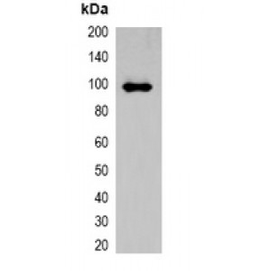 LifeSab™ ECFP-tag Rabbit pAb (50 µl)