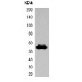 LifeSab™ EYFP-tag Rabbit pAb (50 µl)