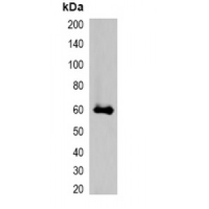 LifeSab™ RFP-tag Rabbit pAb (50 µl)