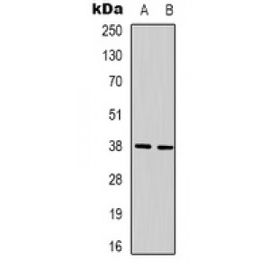 LifeSab™ Acetyl Lysine Rabbit pAb (50 µl)