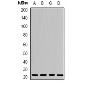 LifeSab™ Methyl Lysine Rabbit pAb (50 µl)