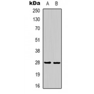 LifeSab™ ACTN1 Rabbit pAb (50 µl)