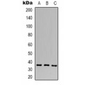 LifeSab™ Calcium Sensing Receptor Rabbit pAb (50 µl)