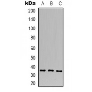 LifeSab™ Calcium Sensing Receptor Rabbit pAb (50 µl)