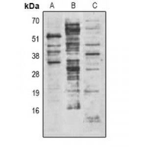 LifeSab™ Pepsinogen C Rabbit pAb (50 µl)