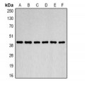 LifeSab™ Acetyl Lysine Mouse mAb (50 µl)