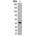 LifeSab™ pan methyl-lysine Rabbit pAb (50 µl)