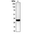 LifeSab™ CDK2 Rabbit pAb (50 µl)