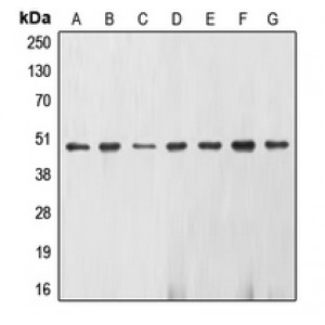 LifeSab™ Gamma-enolase Rabbit pAb (50 µl)