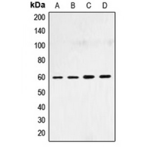 LifeSab™ SMAD4 Rabbit pAb (50 µl)