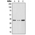 LifeSab™ IKB alpha Rabbit pAb (50 µl)