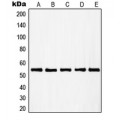 LifeSab™ RAD23B Rabbit pAb (50 µl)