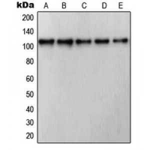 LifeSab™ RB1 Rabbit pAb (50 µl)