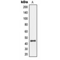 LifeSab™ MKK4 (pS80) Rabbit pAb (50 µl)