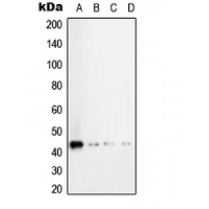 LifeSab™ TGF beta 1 Rabbit pAb (50 µl)