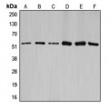 LifeSab™ Cyclin A1/2 Rabbit pAb (50 µl)