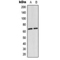 LifeSab™ NF-kappaB p65 (AcK310) Rabbit pAb (50 µl)