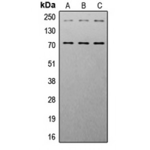 LifeSab™ IGF1 Receptor (pY1161) Rabbit pAb (50 µl)