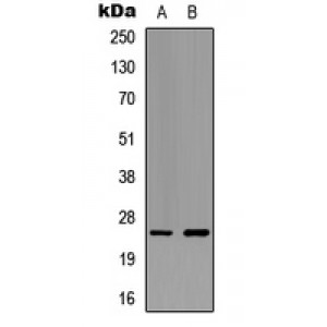 LifeSab™ Ephrin A5 Rabbit pAb (50 µl)